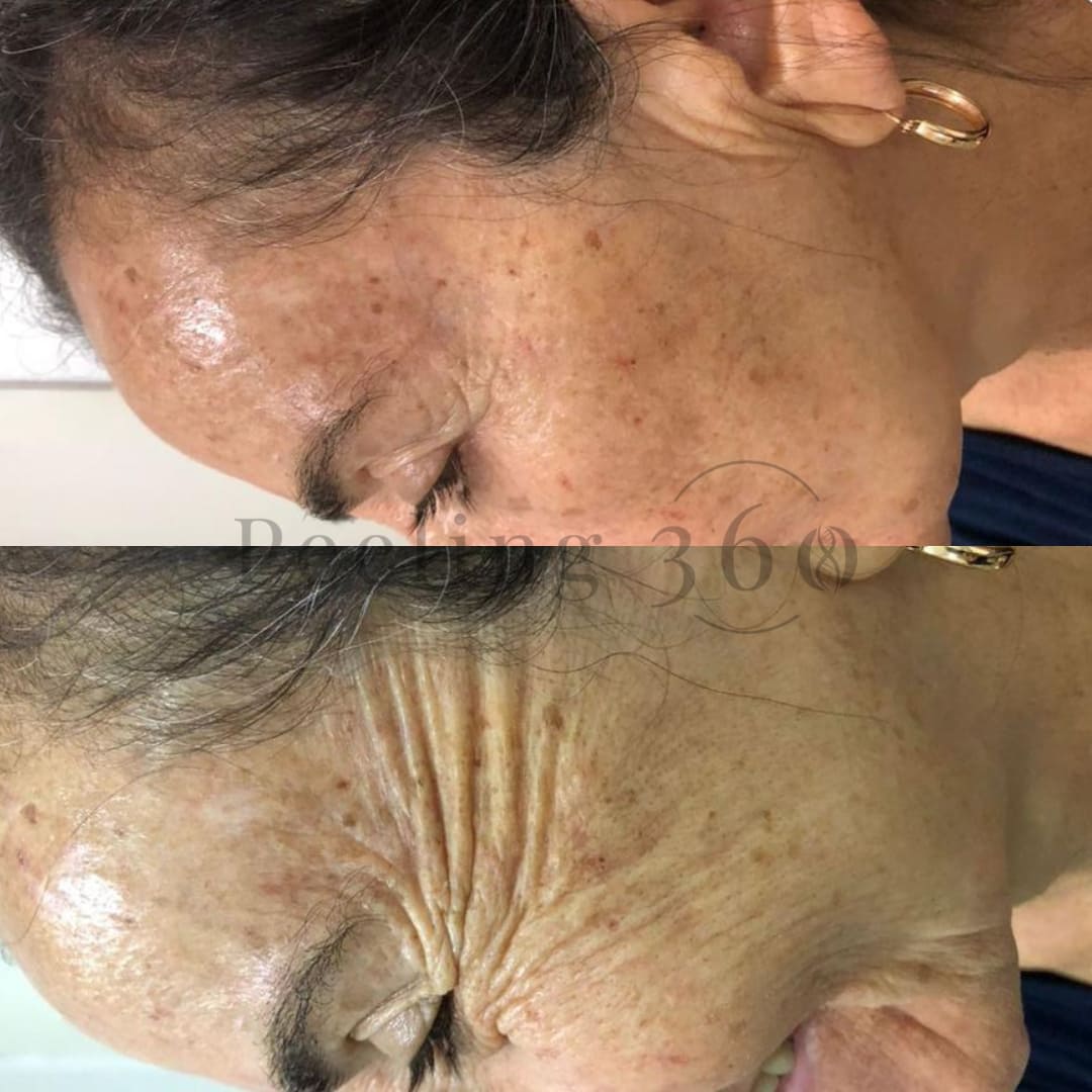Algae Peeling | Organic