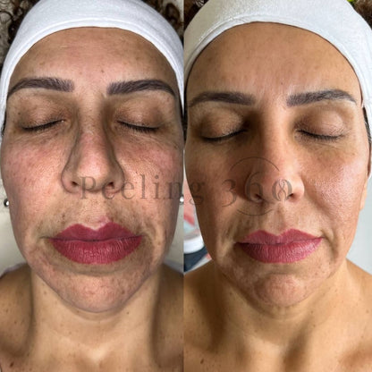 Algae Peeling | Organic
