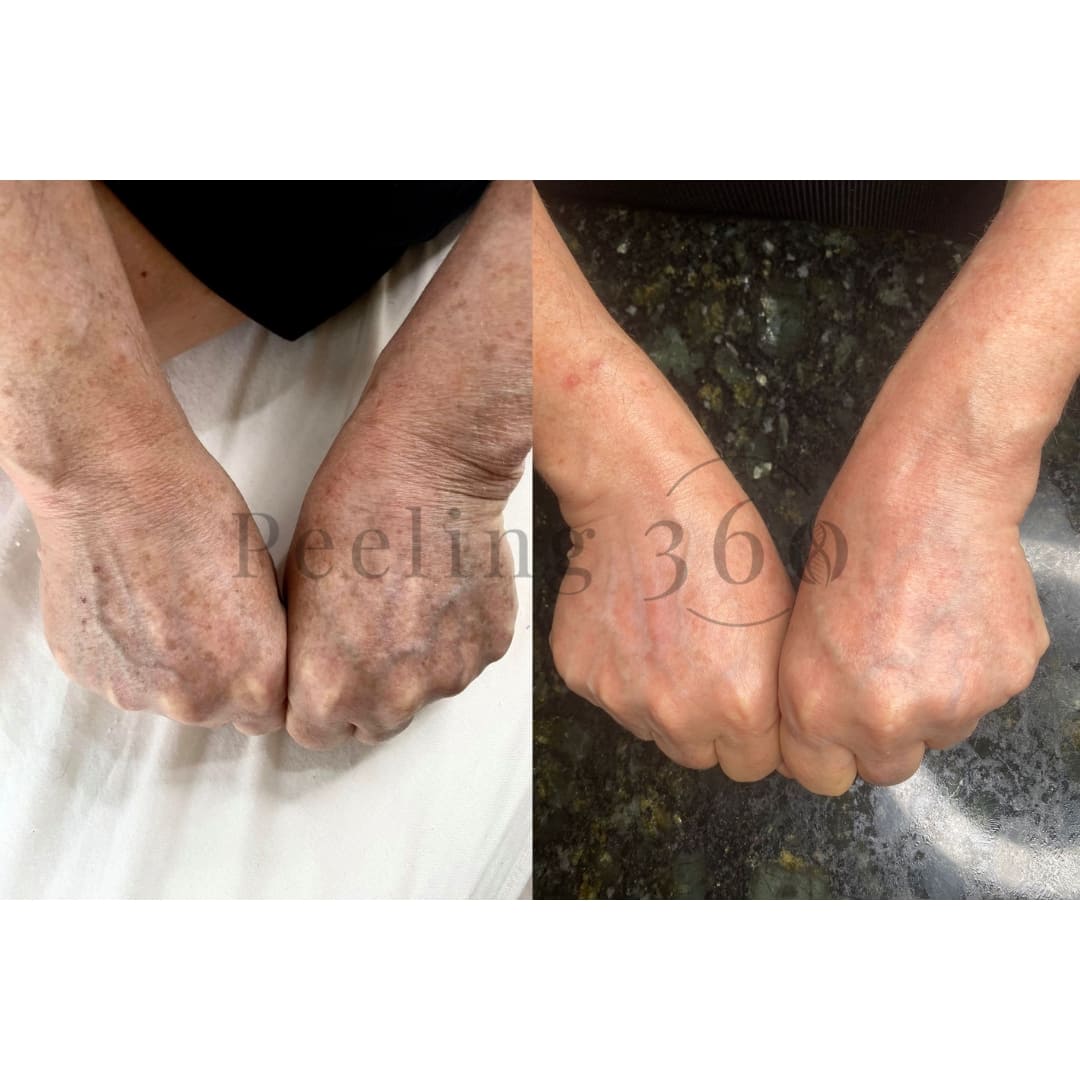 Algae Peeling | Organic