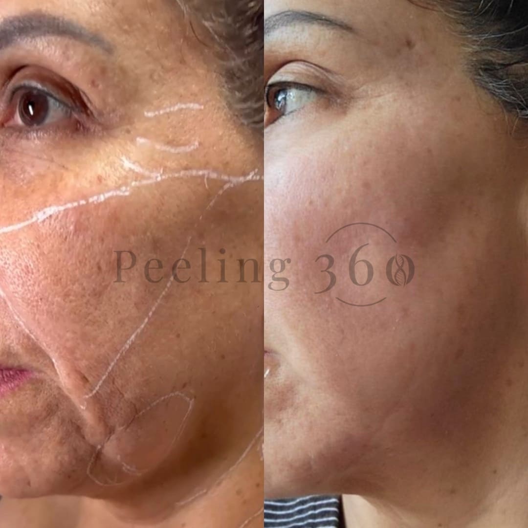 Algae Peeling | Organic