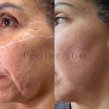 Algae Peeling | Organic