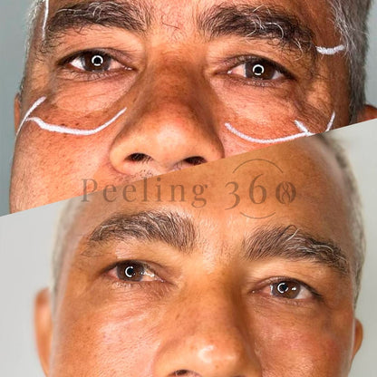 Algae Peeling | Organic