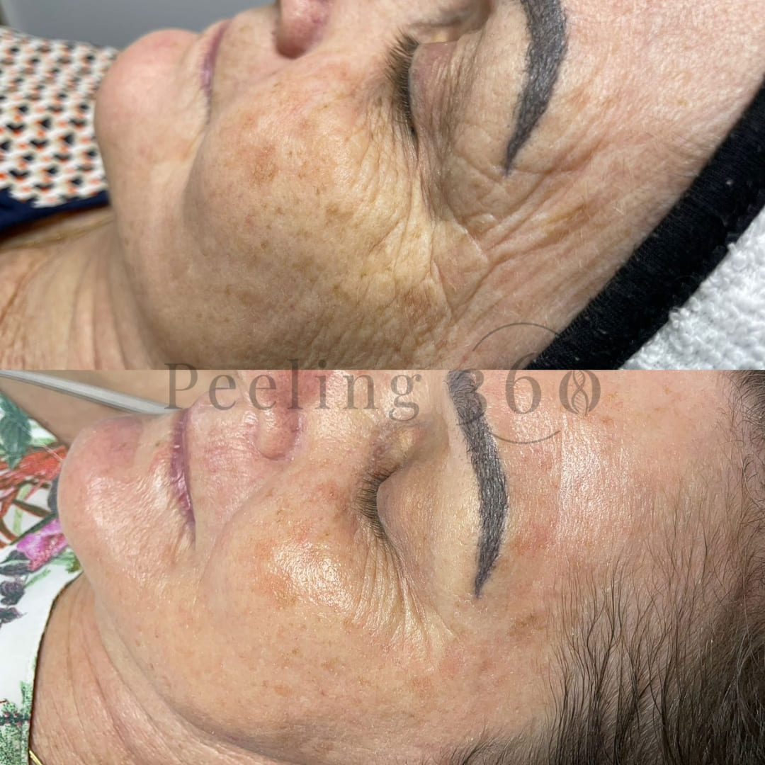 Algae Peeling | Organic