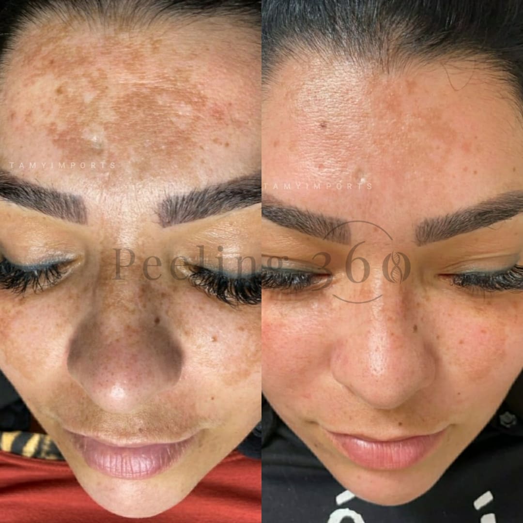 Algae Peeling | Organic