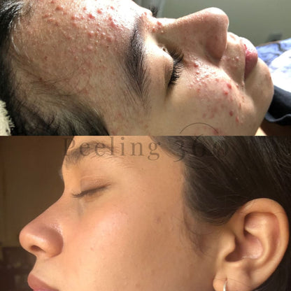 Algae Peeling | Organic